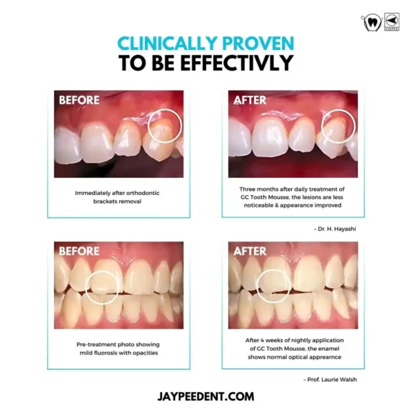 GC Tooth Mousse Plus, Topical Creme with Bioavailable Calcium, Phosphate and Fluoride