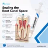 Jaypee Dent Ceramseal Bio Ceramic Sealer Paste, Endodontic Root Canal Sealer For Permanent Obturation, 2G Syringe 5 Jaypee Dent Ceramseal Bio Ceramic Sealer Paste, Endodontic Root Canal Sealer For Permanent Obturation, 2G Syringe
