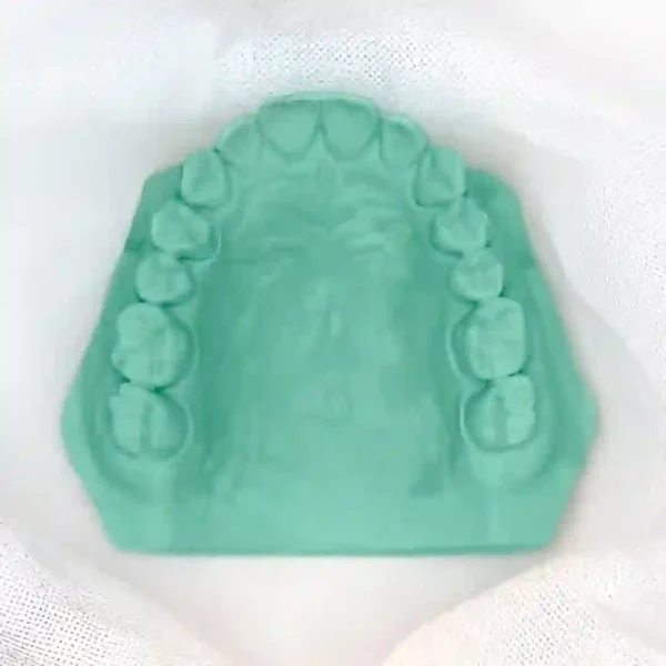 Kalabhai Kalstone Dental Stone Class Iii, 1 Kg