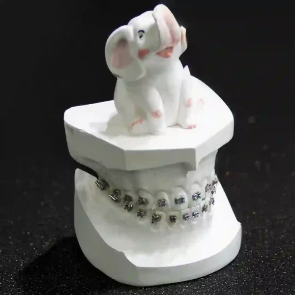 Kalabhai Orthokal Orthodontic Stone Class Iii, 3 Kg