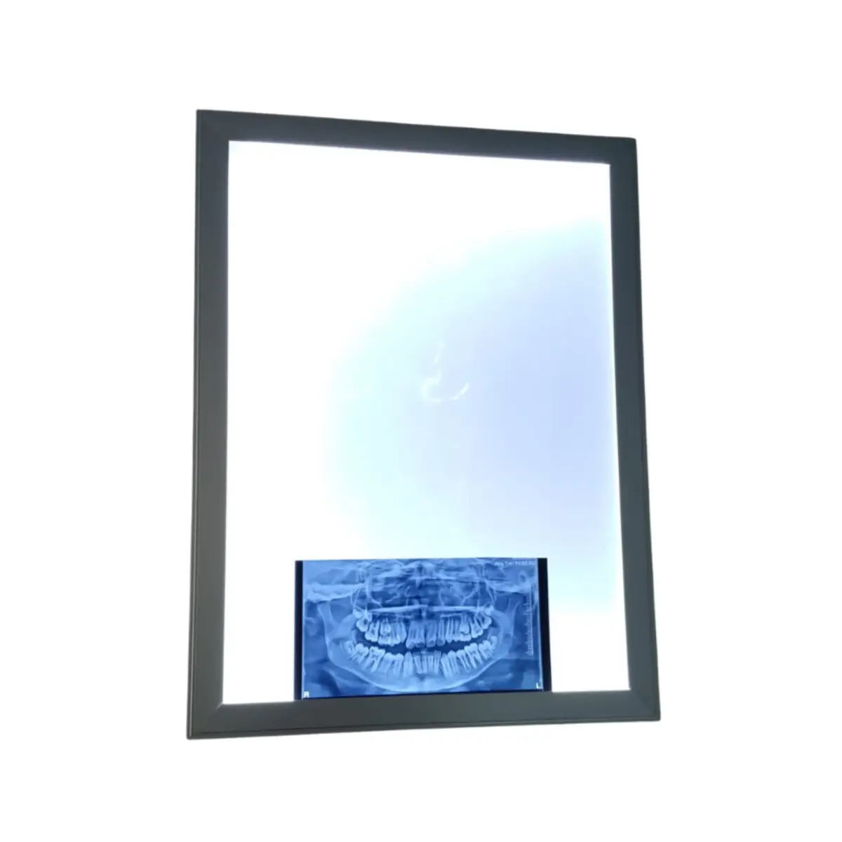 Dental Opg X-Ray Viewer 2 Dental Opg X-Ray Viewer - Image 2