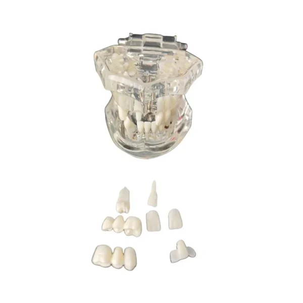 Evodent All in One with Three Implants