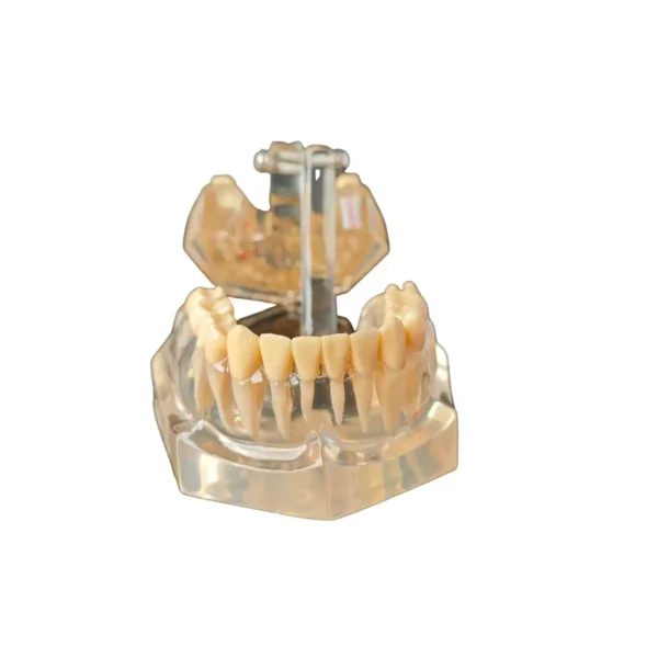 Evodent Enlarged Pathology Model, Clear