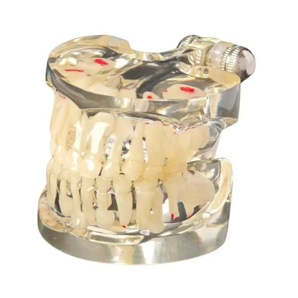 Evodent Mixed Dentition Model without Caries, Clear