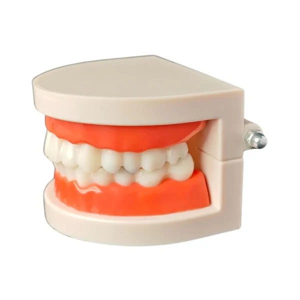 Evodent Model With Caries