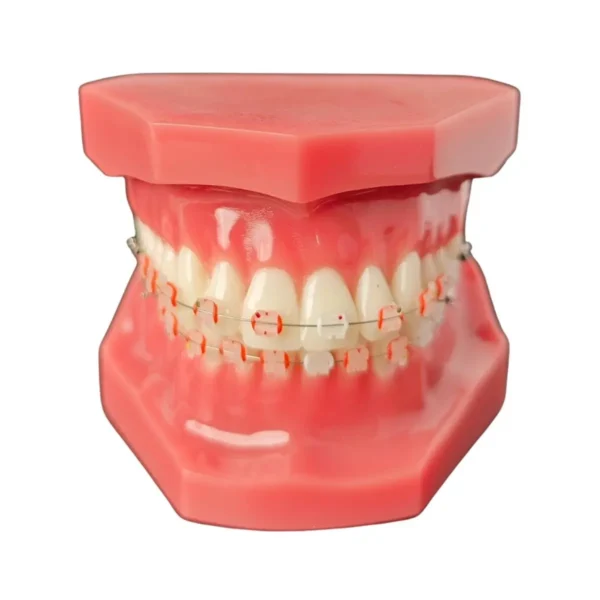Evodent Orthodontic Model with Ceramic Bracket, Pink