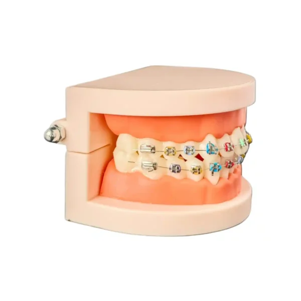 Evodent Orthodontic Model with Metal Bracket