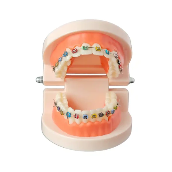 Evodent Orthodontic Model with Metal Bracket