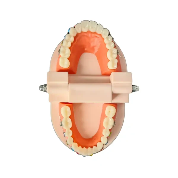 Evodent Orthodontic Model with Metal Bracket