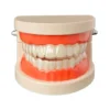 Evodent Ideal Dental Model With Aligner
