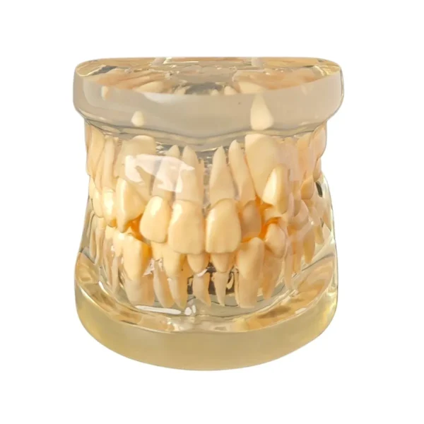 Evodent Orthodontic Model Class I Malocclusion Clear