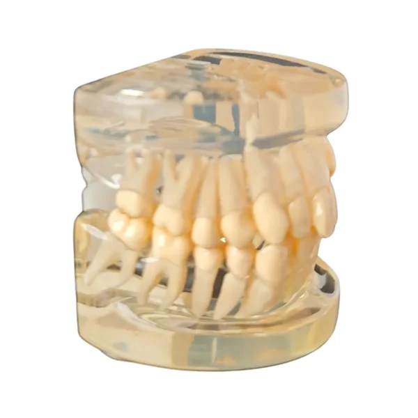 Evodent Orthodontic Model Class I Malocclusion Clear