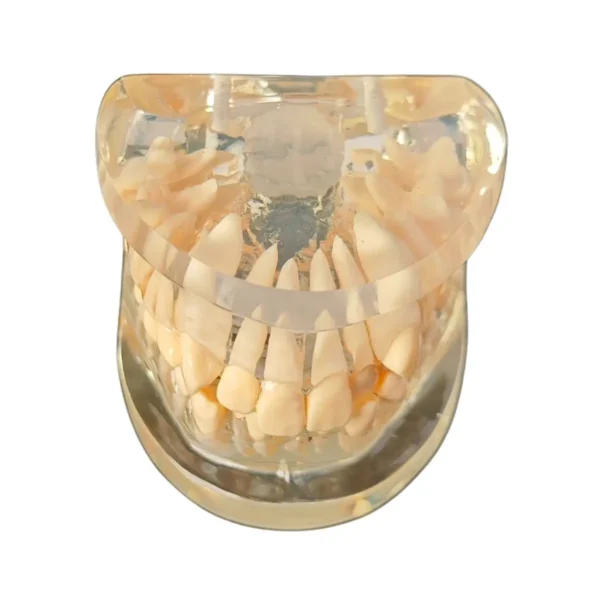 Evodent Orthodontic Model Class I Malocclusion Clear