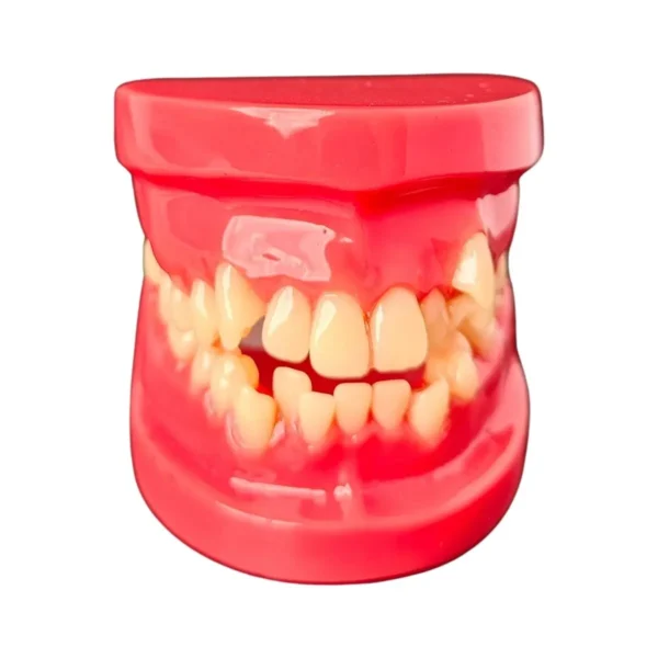Evodent Orthodontic Model Class I Malocclusion Clear, Pink