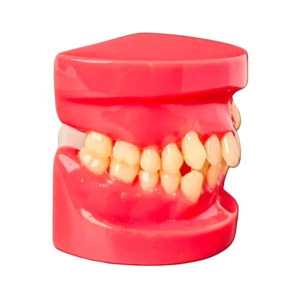 Evodent Orthodontic Model Class I Malocclusion Clear, Pink