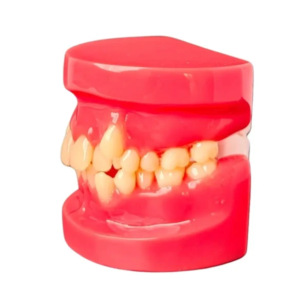 Evodent Orthodontic Model Class I Malocclusion Clear, Pink