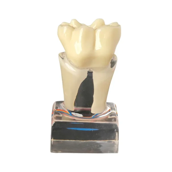 Evodent Tooth Morphology Cross Section with Nerve Supply