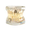 Evodent All In One With Nerve Supply, Clear