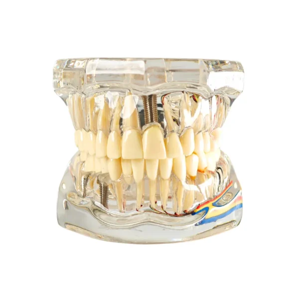 Evodent All in One with Nerve Supply, Clear