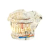 Evodent All In One With Nerve Supply, Clear
