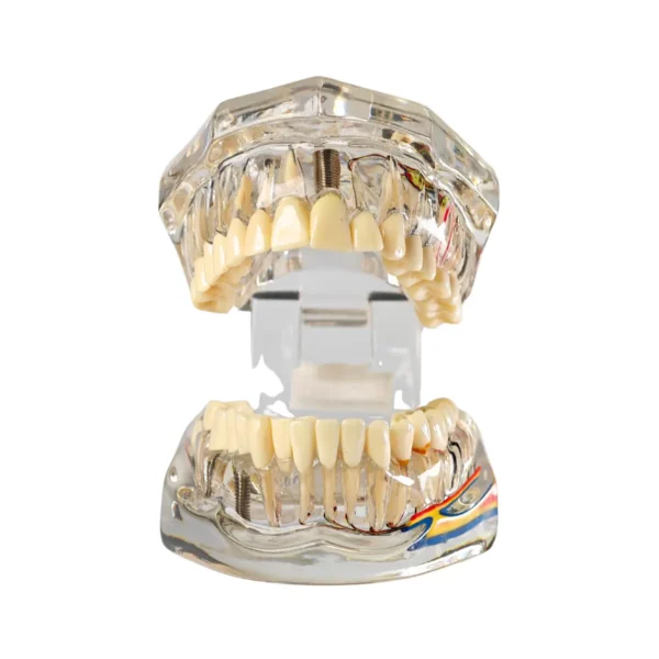 Evodent All in One with Nerve Supply, Clear