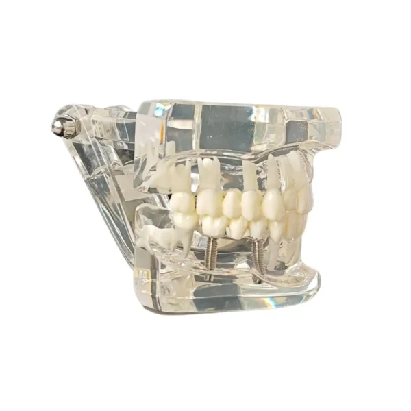 Evodent All in One with Pathology and Implant, Clear