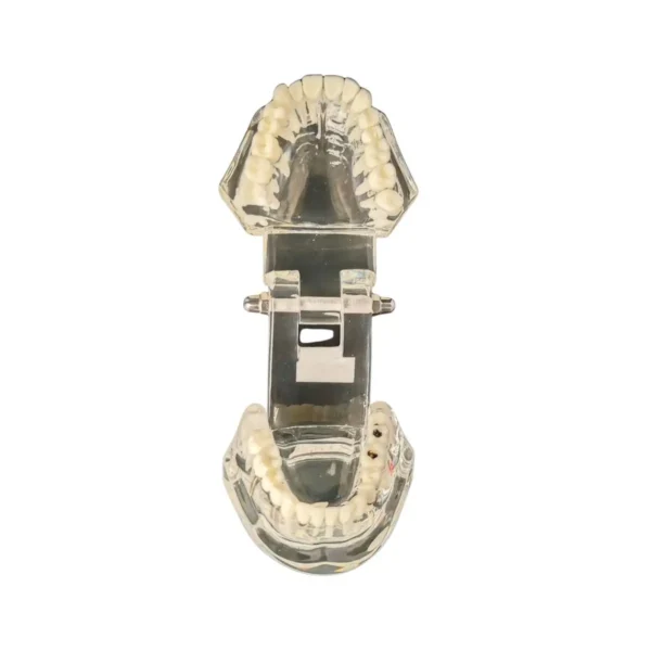 Evodent All in One with Pathology and Implant, Clear