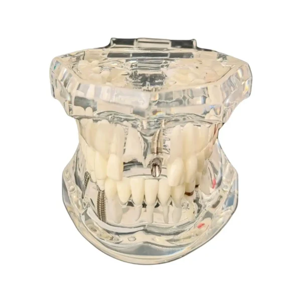 Evodent All in One with Pathology and Implant, Clear