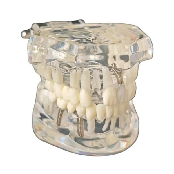 Evodent All in One with Pathology and Implant, Clear