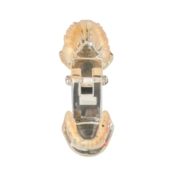 Evodent All in One with Three Implant FPD