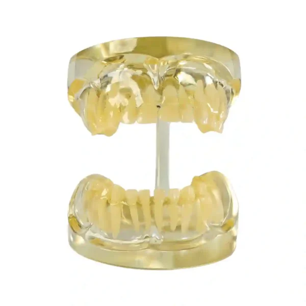 Evodent Deciduous Teeth Model, Clear