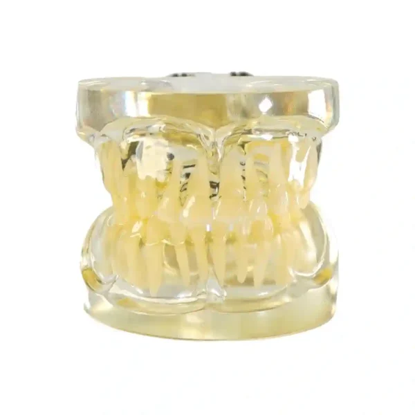 Evodent Deciduous Teeth Model, Clear