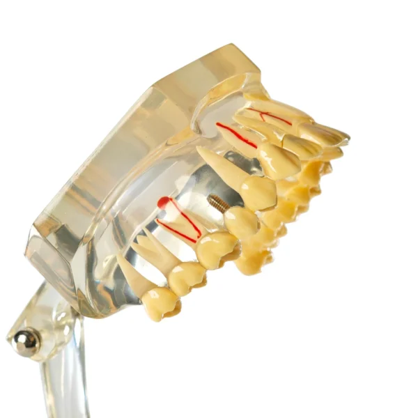 Evodent Enlarged Pathology Model, Clear