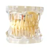 Evodent Enlarged Pathology Model, Clear