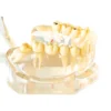 Evodent Enlarged Pathology Model, Clear