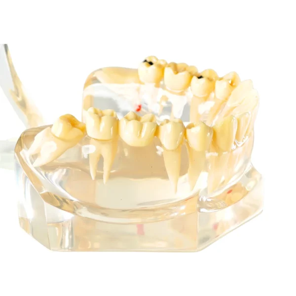 Evodent Enlarged Pathology Model, Clear