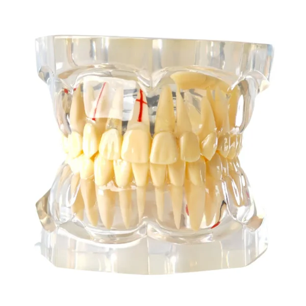 Evodent Enlarged Pathology Model, Clear