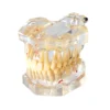 Evodent Enlarged Pathology Model, Clear