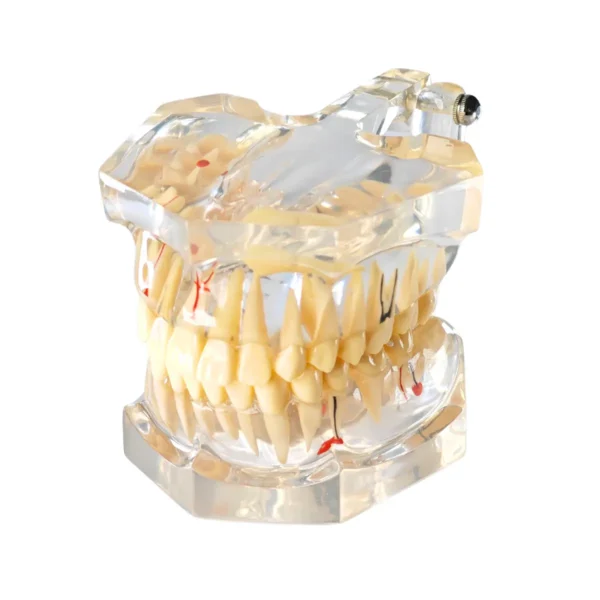 Evodent Enlarged Pathology Model, Clear