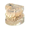 Evodent Malocculation Model With Metal Bracket, Clear