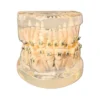 Evodent Malocculation Model With Metal Bracket, Clear