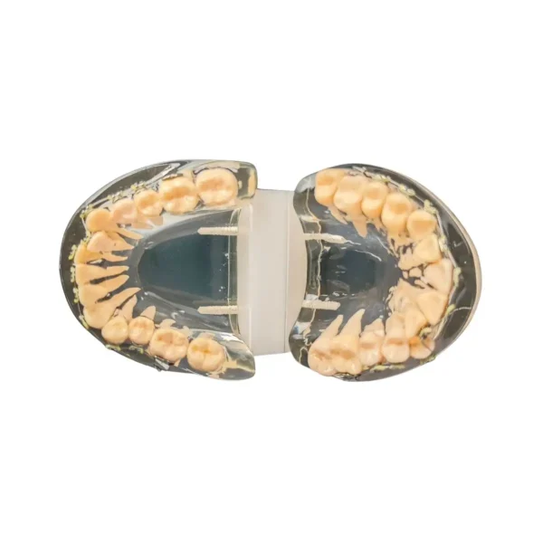 Evodent Malocculation Model with Metal Bracket, Clear