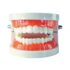 Evodent Model With Caries
