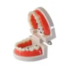 Evodent Model With Caries