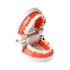 Evodent Model With Caries