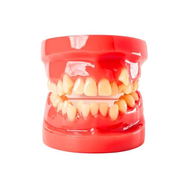 Evodent Orthodontic Model Class I Malocclusion, Pink