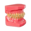 Evodent Orthodontic Model Half Metal And Half Ceramic Bracket