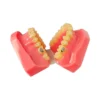 Evodent Orthodontic Model Half Metal And Half Ceramic Bracket