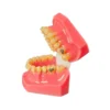 Evodent Orthodontic Model Half Metal And Half Ceramic Bracket