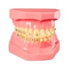 Evodent Orthodontic Model Half Metal And Half Ceramic Bracket